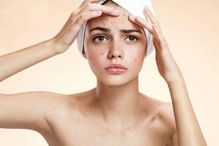 1647680543123034.jpg 祛痘.jpg